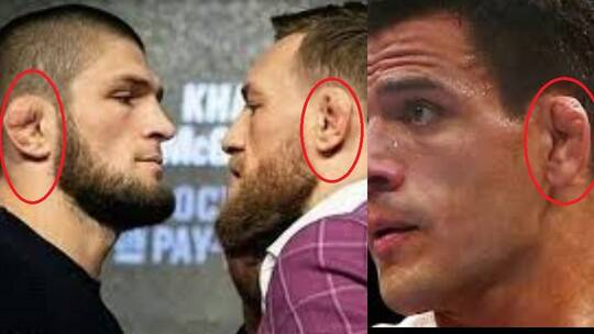 لماذا تبدو آذان المقاتلين مشوهة؟