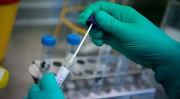 الأردن: تسجيل (175) اصابة بفيروس كورونا.. منها (171) محلية