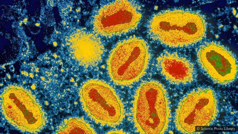 فيروس كورونا: ما الذي يجعل بعض الفيروسات القاتلة تختفي فجأة؟