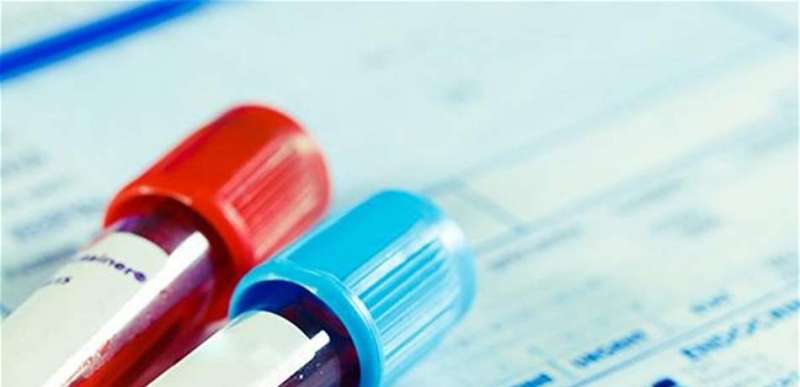 تسجيل 14 إصابة جديدة بفيروس كورونا في عجلون