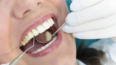 ألم الأسنان قد يكون من أعراض مرض خطير