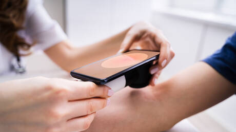 دراسة تكشف قدرة دواء شائع على الوقاية من بعض أنواع سرطان الجلد