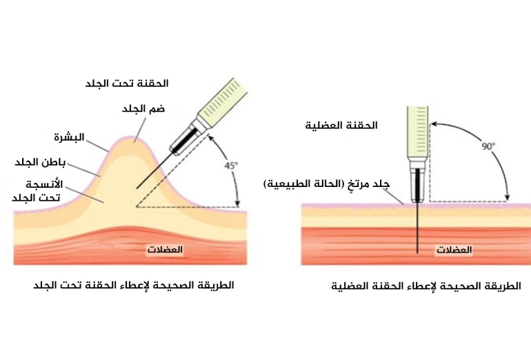 بالصورة والشرح المفصل.. هذه الطريقة الصحيحة لحقنة لقاح كورونا في العضل