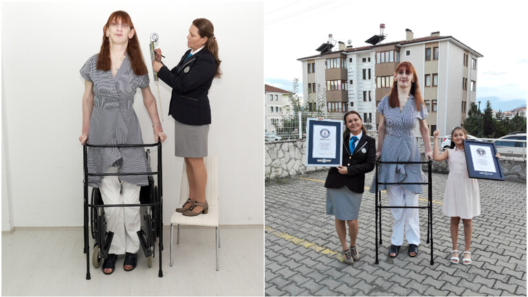 تركية تدخل غينيس كونها أطول امرأة على قيد الحياة في العالم