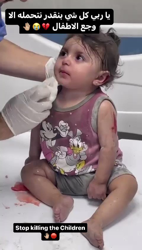 ديانا حداد تعلق على مقطع فيديو مؤثر لطفلة فلسطينية جريحة