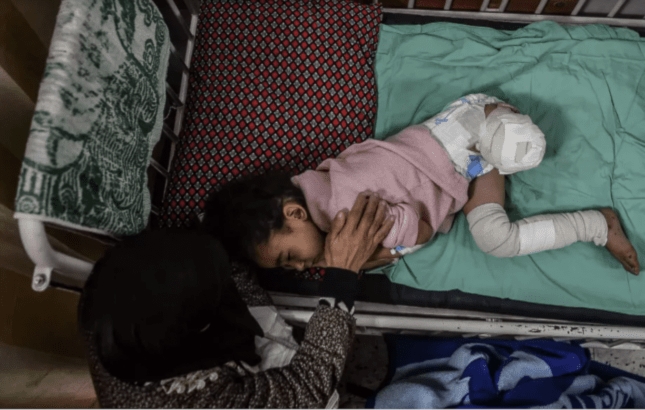 تقرير: (10) اطفال يوميا يفقدون ساقا واحدة او كلتيهما في غزة