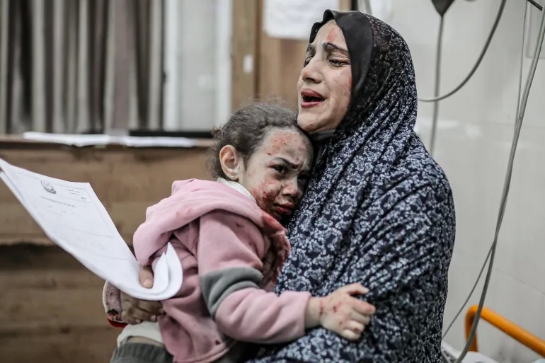 ط م ب أ ح الاختصار الجديد المرعب الذي يستخدمه الأطباء للضحايا الصغار في غزة