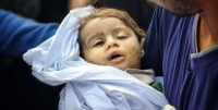 ارتفاع حصيلة الشهداء إلى 34#44;654 والجرحى إلى 77#44;908 منذ بدء العدوان على غزة