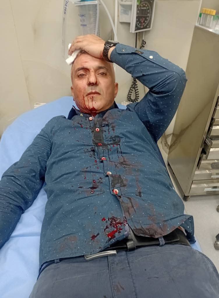 الاعتداء على الصحفي فارس الحباشنة أمام منزله.. والجهات الأمنية تحقق