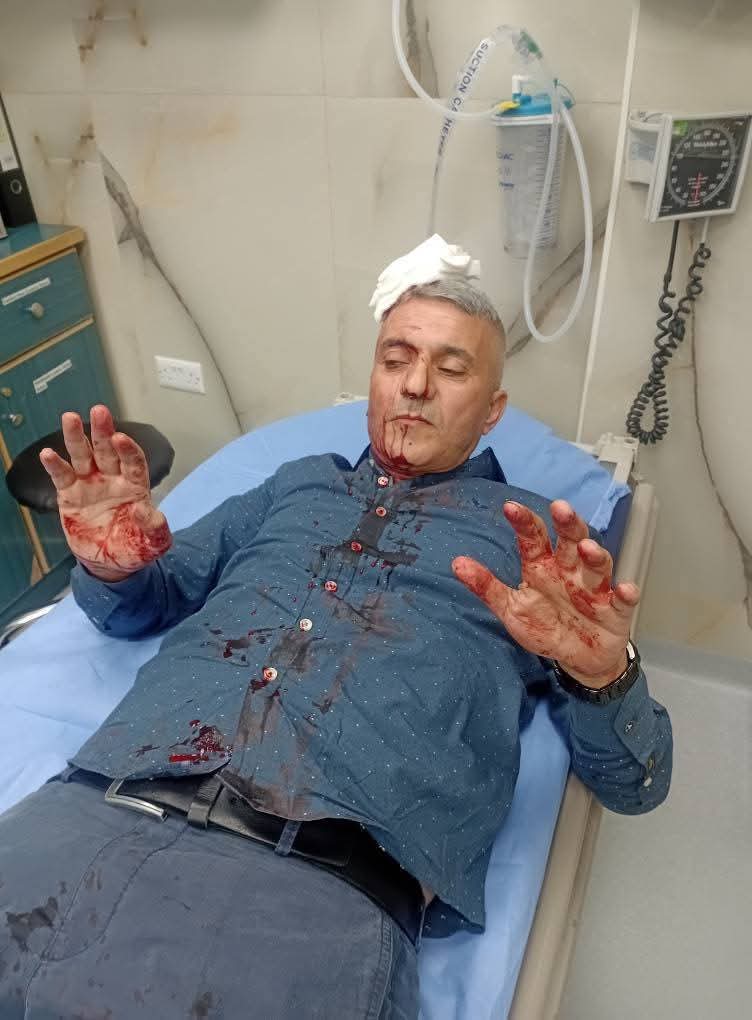 الاعتداء على الصحفي فارس الحباشنة أمام منزله.. والجهات الأمنية تحقق