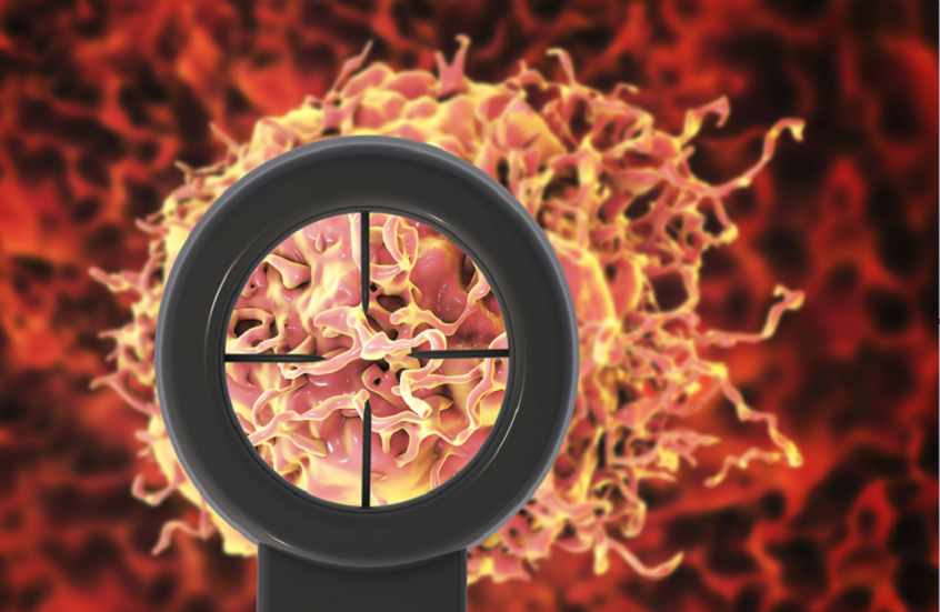 اكتشاف جديد يمهّد لتطوير علاج فعّال لسرطان البروستات