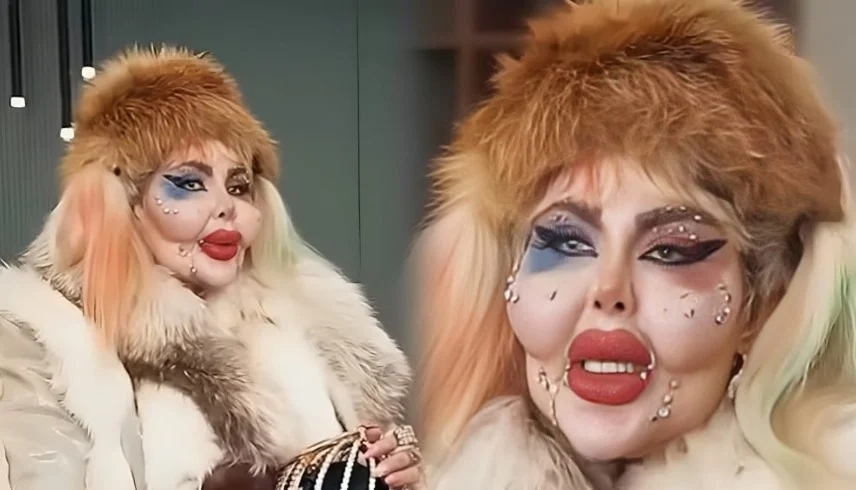 388 عملية تجميل و8 سنوات بلا طعام.. بلوغر شهيرة تثير جدلاً بسر رشاقتها المروع