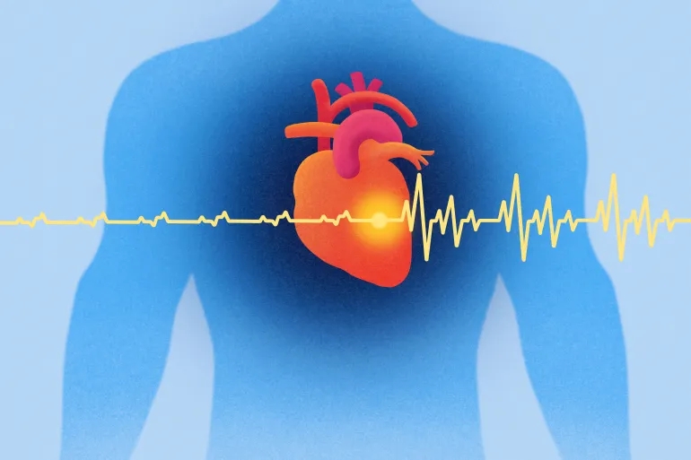 ‫ما أسباب الرجفان الأذيني؟