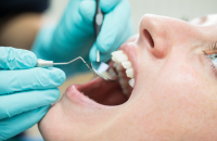 علاقة وثيقة بين حالة الأسنان وطول العمر