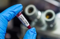 إجراءات سريعة في الهند لمواجهة فيروس خطير لا علاج له تنقله الثعالب الطائرة