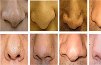 لماذا لا يوجد أنف مثالي يناسب الجميع؟