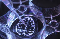 اكتشاف سر العلاقة بين السرطان وانخفاض خطر الخرف