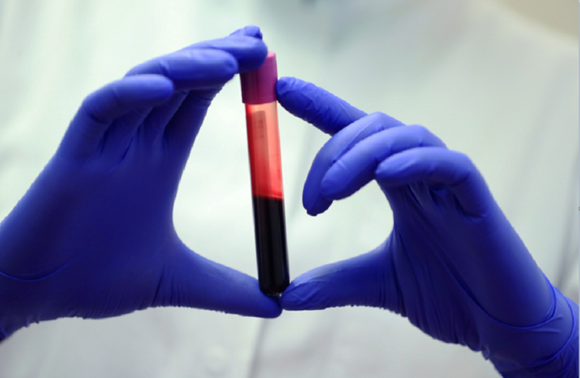 ثورة طبية جديدة.. فحص دم بسيط يتنبأ بمن سيعيش لفترة أطول