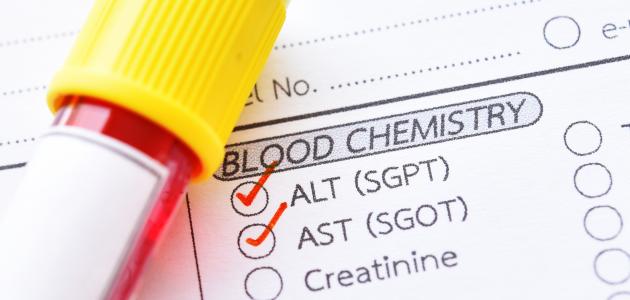 تحليل إنزيمات الكبد: Alt وAst