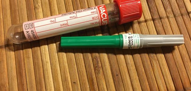 تحليل البرولاكتين: أهم المعلومات والأسباب والإجراءات