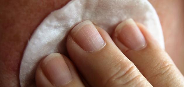 أفضل طرق علاج النخالة البيضاء بفعالية