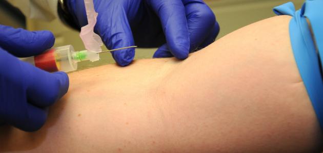 تحليل tsh وأهميته للنساء