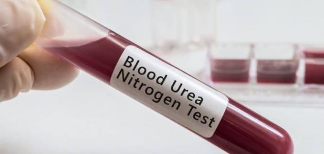 أسباب ارتفاع نيتروجين اليوريا وعلاماته