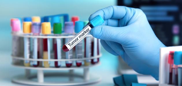 تحاليل دلالات الأورام: أهمية وفوائد استخداماتها