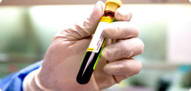 فحص CBC: تحليل شامل لمكونات الدم