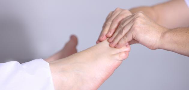 احتباس السوائل: الأسباب وطرق التخلص منها