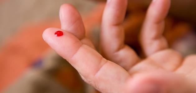 معدل السكر الطبيعي في جسم الإنسان