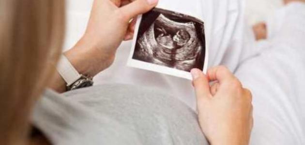 صدمة الأمومة: هل تعني قلة حركة الجنين في الشهر الرابع خطرًا محدقًا؟ (تحليل 2024 ورؤية 2026)