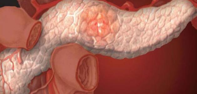 وظائف البنكرياس: دليل شامل لتركيبه وأهميته وأمراضه