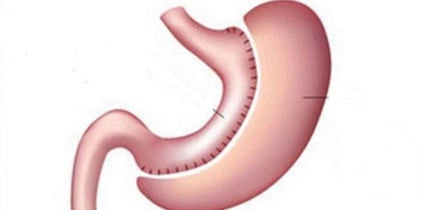 طرق طبيعية لتصغير المعدة: دليل شامل لعام 2026