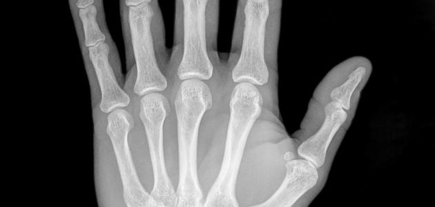 تألقي ببشرة مشعة: قوة فيتامين سي لعام 2026