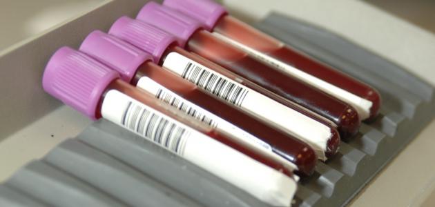 تحليل الدم لتأكيد الحمل