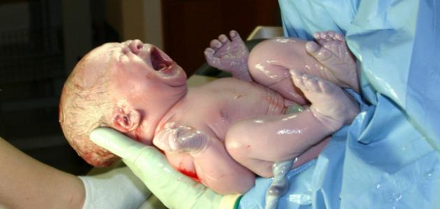 كيفية خروج الجنين: مراحل الولادة الطبيعية والقيصرية