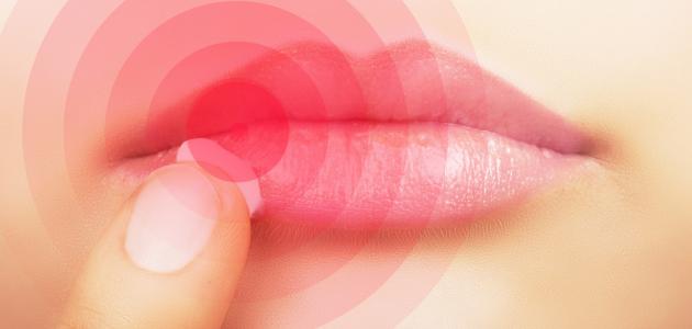 تحليل أسباب تشقق الشفاه: رؤى شاملة وحلول فعالة