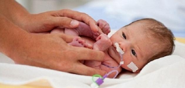 الولادة المبكرة: الأسباب والمضاعفات وكيفية التعامل معها