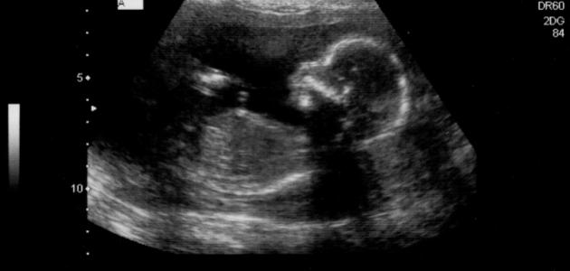 تطورات الجنين في الأسبوع السابع عشر من الحمل: دليل شامل