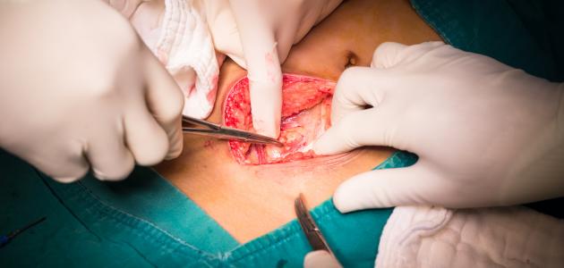 التهاب الزائدة الدودية: الأسباب والأعراض وطرق العلاج الحديثة