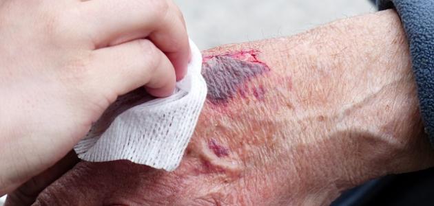 صدمة نقص فيتامين د: كيف تدمر بشرتك في صمت وماذا تفعل قبل 2026؟