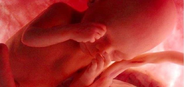 انفصال المشيمة: الأسباب والأعراض والمضاعفات