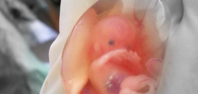 الإجهاض المتكرر: الأسباب، التشخيص، وطرق العلاج الحديثة