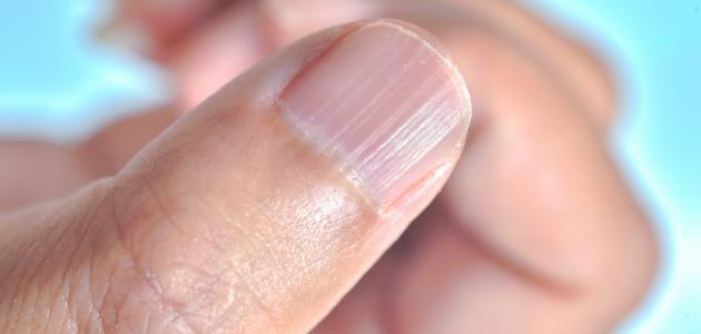 أعراض نقص الزنك: وباء صامت يهدد صحة 30% من سكان العالم ويزداد حدة بحلول 2026