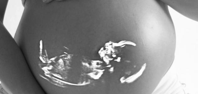 تحجّر البطن في الشهر التاسع: دليلكِ الشامل لعام 2026