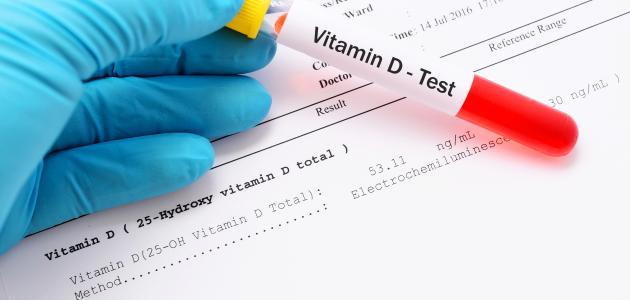 تحليل شامل: نقص فيتامين د - الأسباب والآثار والعلاج