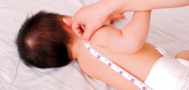ضعف النمو عند الرضع: الأسباب، الأعراض، وطرق العلاج