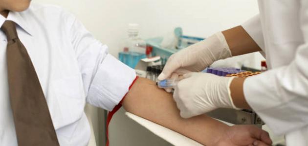 فوائد سحب الدم وأهميته لصحة الإنسان