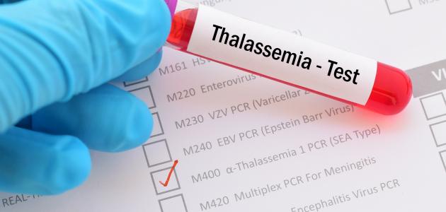 الثلاسيميا وأهمية الفحوصات قبل الزواج